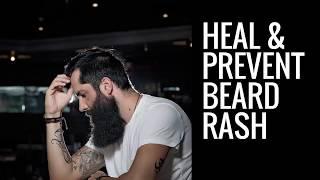 How To Heal and Prevent Beard Rash