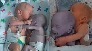 The nurse places a healthy baby next to her dying twin and a miracle happens