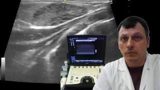 Pediatric mammary glands ultrasound - Neonatal mastitis