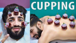 Wet Cupping Therapy \ Hijama for Skin Care  My First Hijama Cupping