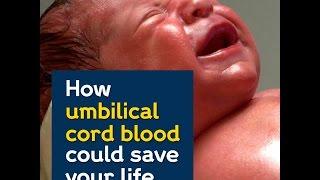 How umbilical cord blood could save your life