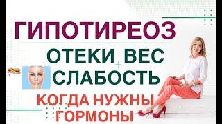  СЛАБОСТЬ ОТЕКИ НАБОР ВЕСА- ГИПОТИРЕОЗ КОГДА ВВОДИТЬ ГОРМОНЫ Врач эндокринолог Ольга Павлова