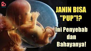 Penyebab Janin BAB di Dalam Kandungan Waspadai Bahayanya