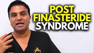 Post Finasteride Syndrome Is the Incidence Significant?