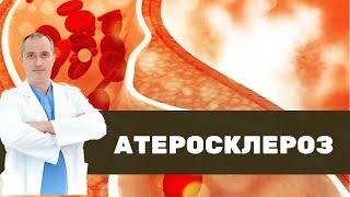  Что такое атеросклероз на самом деле?