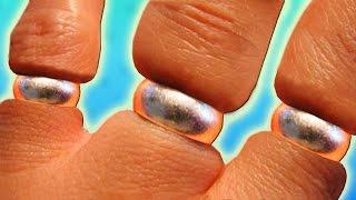 How To Remove A Ring From A Swollen Finger  Life Hack  BEST METHOD