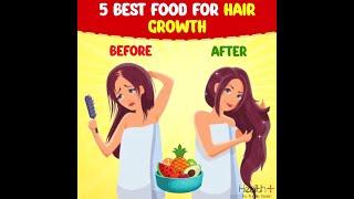 5 Best Food for Hair Growth