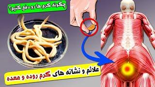 علائم و نشانه های کرم روده و معده و درمان فوری