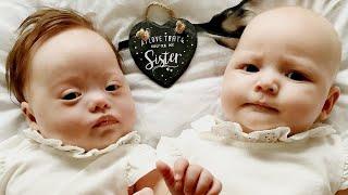 Mom Has Twins One With Down Syndrome in Rare Birth