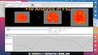 Finite Impulse Response FIR Analysis in FSL