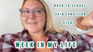 Week in my Life - Addressing my skin condition