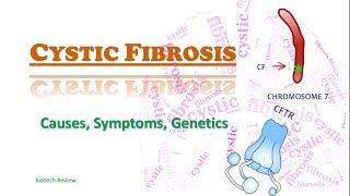 Cystic Fibrosis  a genetic disorder that affects Lungs pancreas liver and Kidneys