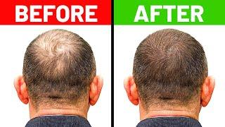 10 Home Remedies To Prevent Hair Loss and Regrow Your Hair