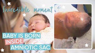 Incredible En Caul Birth  Channel Mum