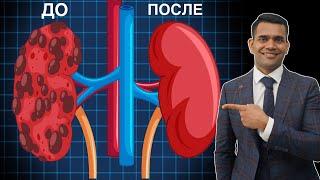 Как Вылечить И Очистить Свои Почки Доктор Вивек.