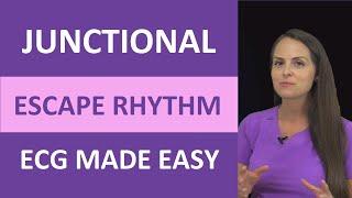 Junctional Escape Rhythm ECG Made Easy Nursing Next Generation NCLEX EKG