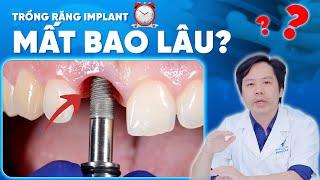 Trồng Răng Implant Mất Bao Lâu? Liệu Có Lắp Răng Ngay Sau Khi Đặt Trụ Implant Như Lời Đồn?