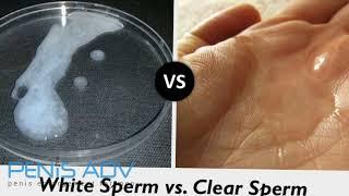Difference Between White and Clear Sperm