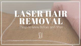 Laser Hair Removal Things To Know Before & After