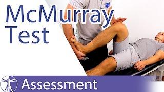 McMurray Test  Meniscus Damage