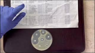 Метод стандартных дисков  Микробиология