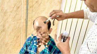 Hair patch service kaise Hoti Hai? #parvezhair #servicehairpatch