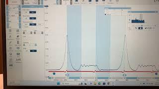 Diagnosing Engine Performance Issues Using an In Cylinder Pressure Transducer Detailed Analysis