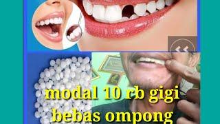 cara memasang gigi palsu tentooth sendiri. murah meriah kuat