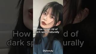 How To Get Rid Of Dark Spots Naturally #glowup #aesthetic #girl #aestheticgirl #shorts #youtube