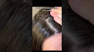 Top 3 Scalp Exfoliation Tips for Healthier hair.#viral #shorts #Split Ends #HairCare