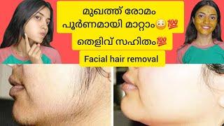 മുഖത്തെ രോമം പൂർണമായി മാറ്റാം facial hair removal #homeremedy #facialhairremovalforwomen