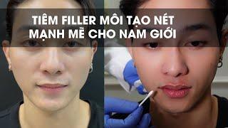 Tạo dáng môi mạnh mẽ cho ca sĩ Roy Nguyễn bằng Filler  Bác sĩ Khải EVA