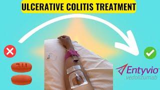 My Journey with Ulcerative Colitis How Biologics Changed Everything