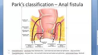 Surgery 806 Parks classification anal fistula types fistula in ano Intersphincteric transsphincteric