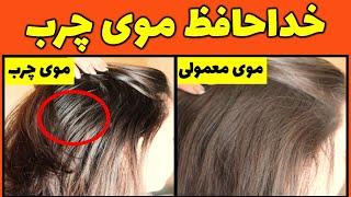 علت چربی پوست سر چیست؟درمان موی چرب به روش خانگیدرمان چربی موی سر