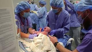 Skin to Skin with your Baby during Caesarian Section – What to Expect