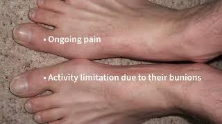 Advanced Treatments Available for Bunions