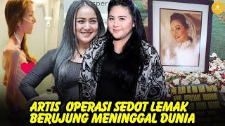 nasib mereka sungguh miris8 artis operasi sedot lemak  berujung meninggal dunia