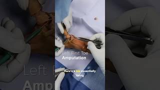 Left First Toe Amputation - Cadaver Edition #orthopedic #doctor #toe #medicine #hospital #watch #OR