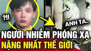 Chàng trai người Nhật NHIỄM PHÓNG XẠ nặng nhất thế giới và 83 ngày ĐỊA NGỤC  Tin 3 Phút