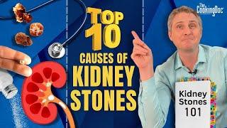 The Top 10 Causes of Kidney Stones  The Cooking Doc®