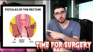 Perianal Fistula Surgery Explained - Horrific Pain‼️