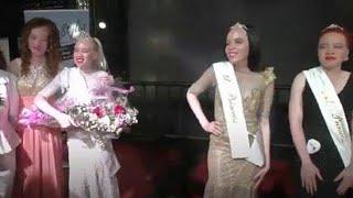 Zimbabwe crowns its first Miss Albino with $85 prize money