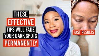 FADE YOUR DARK SPOTS WITH 5 EFFECTIVE TIPS PERMANENTLY “Fast Results”