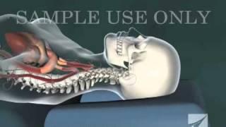 Cervical Chiropractic Adjustment