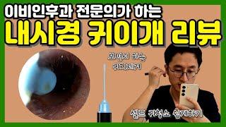 이비인후과 전문의가 하는 내시경 귀이개 리뷰 Home Earwax Removal Tool