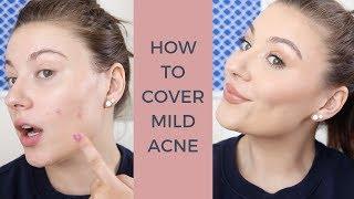 HOW TO COVER ACNE WITH CONCEALER