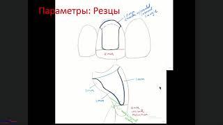 Методики препарирования зубов под цельнокерамические реставрации.18.06.2019