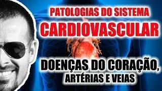 Doenças do Coração Artérias e Veias - Patologias do Sistema Cardiovascular - VideoAula 065