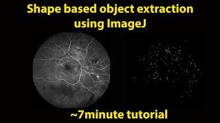 Shape Based Object Extraction in ImageJ or Fiji